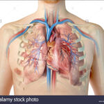 coronary heart disease