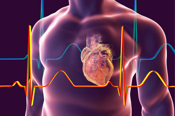 Calcified arteries- what is the significance - eLanka