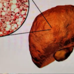 Liver
