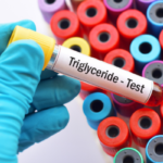 Triglycerides