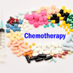 chemotherapy