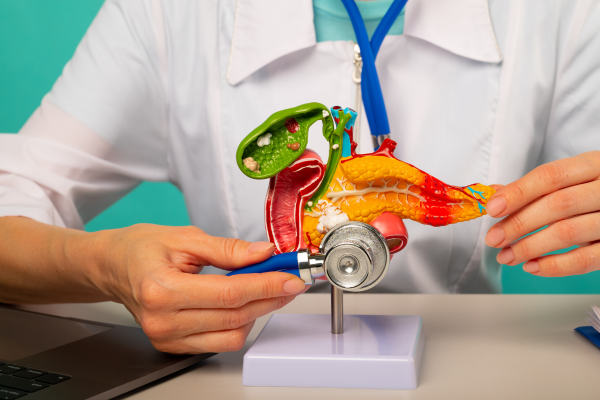 pancreatic cancer