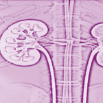 Kidney Dialysis Assistance Programme-eLanka