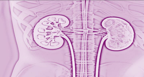 Kidney Dialysis Assistance Programme-eLanka