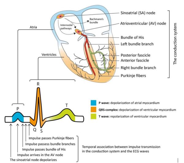 Faulty Heart Beat - Arrythmia