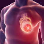 HEART ATTACK AND CARDIAC ARREST - By Dr. Gnana Sankaralingam