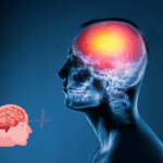 Strokes and Brain Bleeds