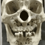 Stolen Skulls-The Untold Colonial Crimes in Sri Lanka