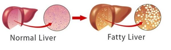 liver